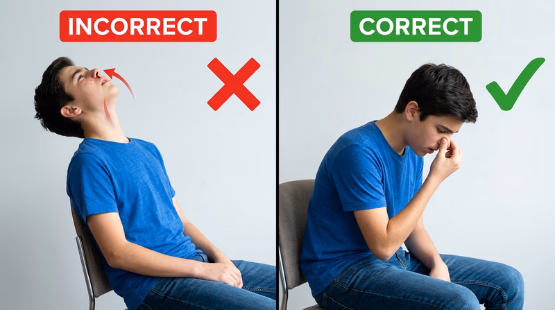 Side-by-side comparison of the wrong head-back posture and the correct slight-forward lean while pinching the soft part of the nose